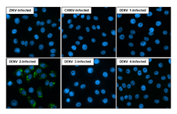 Anti-Dengue virus Envelope protein antibody [GT214] used in Immunocytochemistry/ Immunofluorescence (ICC/IF). GTX629116